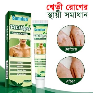 Vitiligo Treatment Herbal Cream 1 pcs